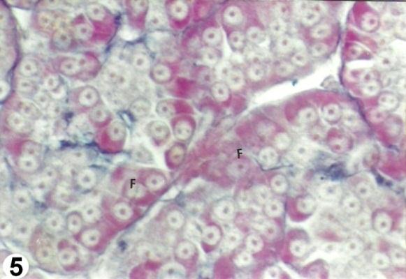 increased number of purple FSH gonadotropic cells (F).