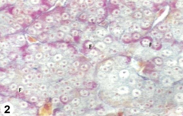 Heidenhain s azan stain X800 Fig (5): Section in the cephalic lobe of 4 weeks