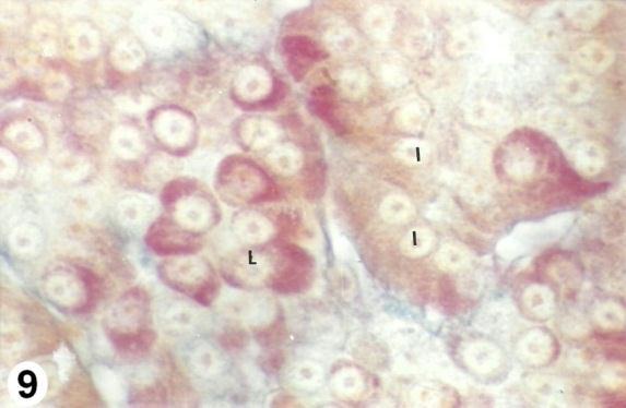 granular and blue thyrotropic cells (T).