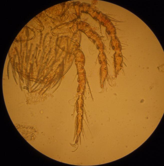 , 2004; Kavitha et al., 2011). Fig 1 Neotrombicula autumnalis harvest mites, (x10) Fig. 2 N.