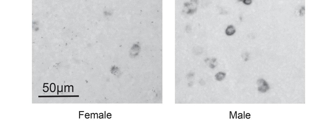 Panel B shows representative images from a control female and male.