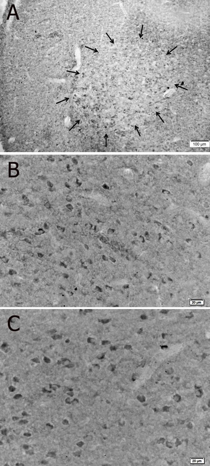 60 Figure 2.8. Photomicrographs of GPR30- ir cells in RA. (A) represents protein labeling in a P21 male.