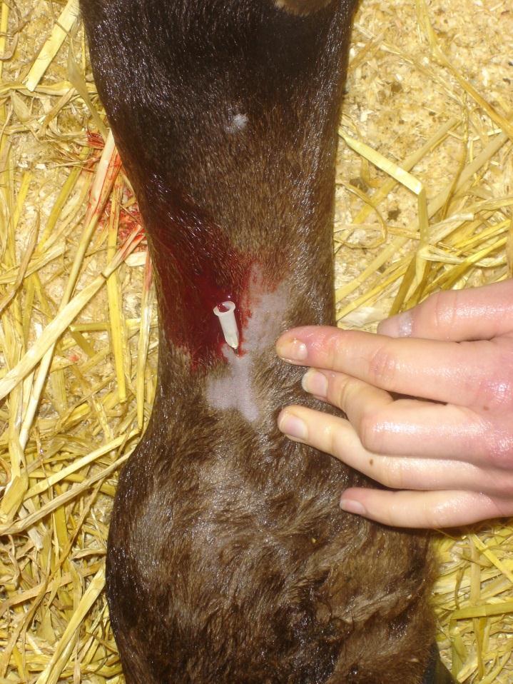 Pain caused by a difficult lambing. Intravenous local anaesthesia before digit amputation. Digit amputation performed under intravenous local anaesthesia.