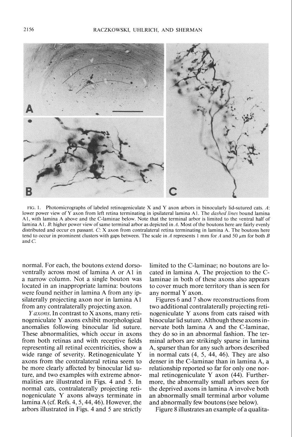 2156 RACZKOWSKI, UHLRICH, AND SHERMAN RG. 1. Photomicrographs of labeled retinogeniculate X and Y axon arbors in binocularly lid-sutured cats.