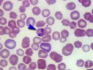Figure1: Babesia canis under the microscope the arrowhead points to a single Babesia organism inside a red blood cell As you might expect, prevention of Ehrlichiosis and Babesiosis is by aggressive