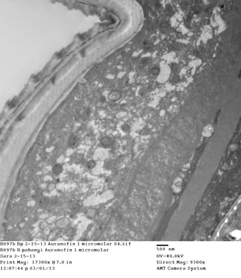 TEM of female worms from in vitro