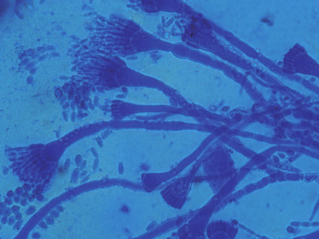 dog referred to the Hospital of Veterinary Clinic at the Federal University of Rio Grande do Sul revealing the presence of Aspergillus hyphae and inflammatory cells. N Figure 5.