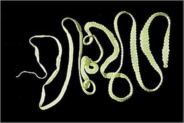 Example B A tapeworm can grow up to 40 feet inside of a host organism!