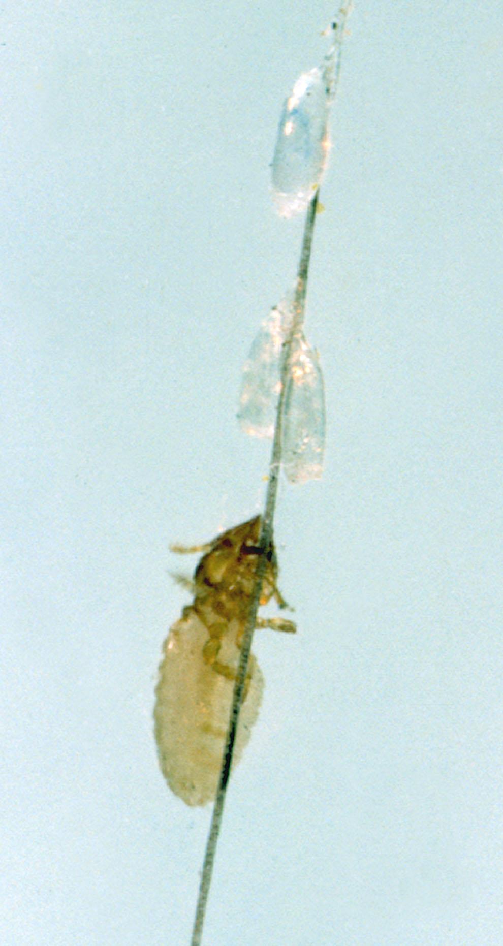 External Parasites on Horses 9 Figure 16. Itch mite. Credits: J. F. Butler, University of host reactions and itching. The host reaction causes the skin to slough off in the infested areas.