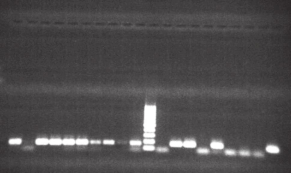 Pattern of genomic DNA from 19 clinical A. baumannii isolates. Lanes 1 10, 12 20 (clinical isolates of A. baumannii), Lane 11 (DNA Ladder 100 bp to 3000 bp).