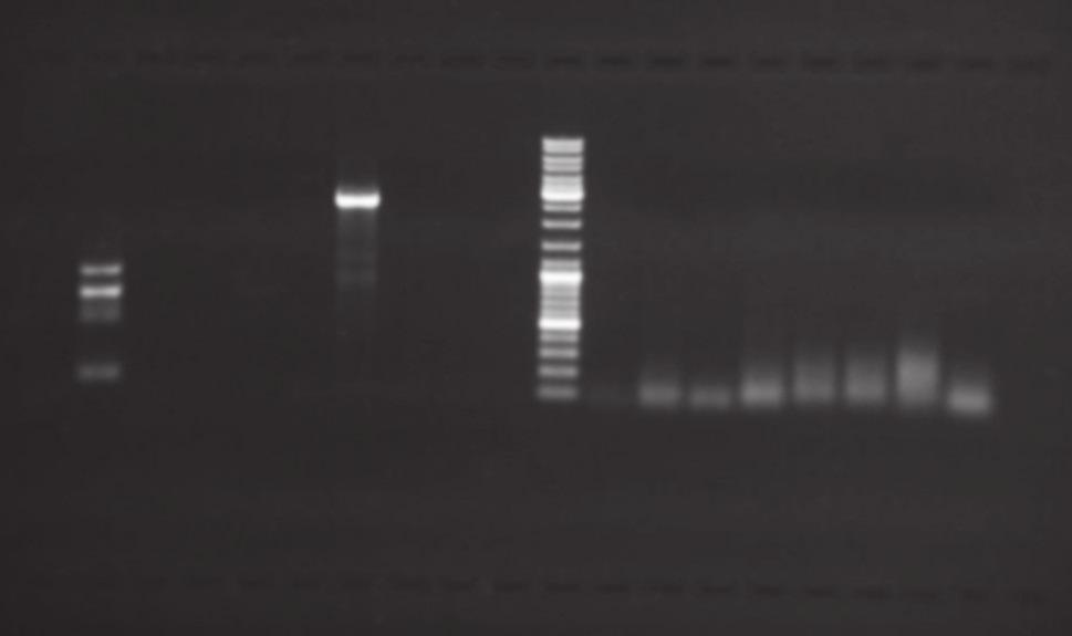 baumannii isolates are shown in Fig. 1. All the isolates not previously compared with REP or other typing methods were revealed to have 20 REP patterns.