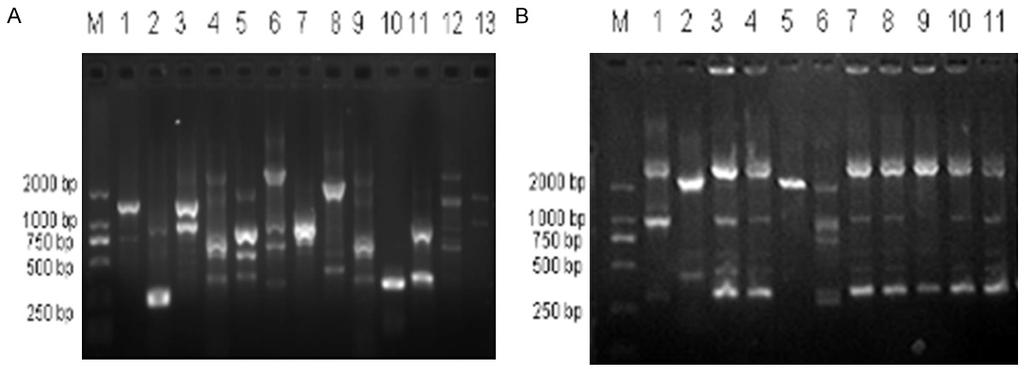 Figure 3. Agarose gel electrophoresis analysis of RAPD genotype of A. baumannii. A: RAPD of partial genotype. 1-13: A-M type; B: RAPD of partical clinically isolated strains.