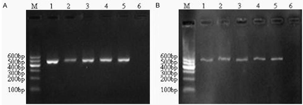 1-5: arma positive strains; 6: arma negative strains. B: Electrophoresis of TEM-1 gene. 1-5: TEM-1 positive strains; 6: TEM-1 negative strains; M: DNA Marker I. Table 5.