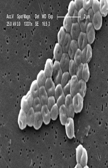 Acinetobacter : The organism Aerobic, Gram-negative bacterium, non motile, non fermenting, coccobacillus in stationary phase, rod shaped in rapid growth, forms biofilms and survives environmental