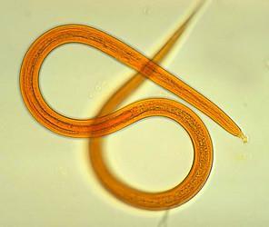 4.Roundworms R o