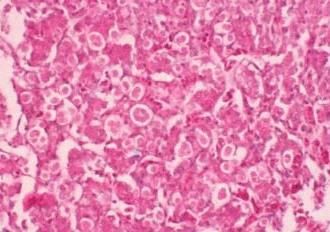 Histomonosis Site of infection Cecum &