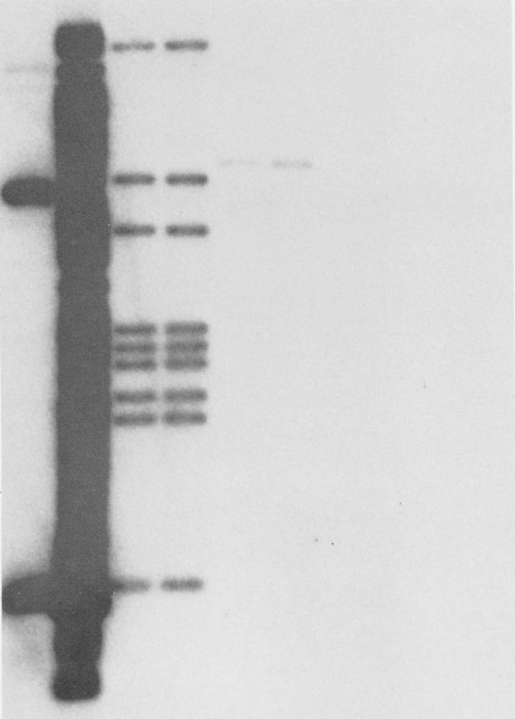 Repetitive DNA element in B. pertussis 2299 AU 23.1 - A B C D E F G 9.4-6.5-4.4. 2.0 1.
