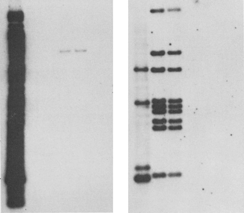 Repetitive DNA element in B. pertussis 2303 kb 23.1 A B C D E F (h) A B C D E F 9.4 6.5 4.4 2.0 1.1 Fig. 5.