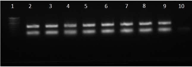 Fig. 1: The photographs show positive confirmation of bla NDM 1 gene from lane 2 to 9 were found positive samples, lane 10 shows negative result and lane 1 associated with 100bp ladder DISCUSSION Non