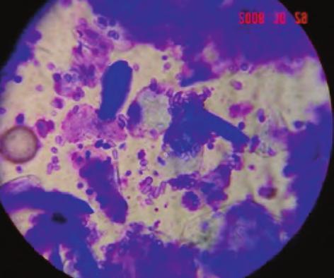 Microorganisms and cells will be seen at the higher magnification using the oil immersion lens.
