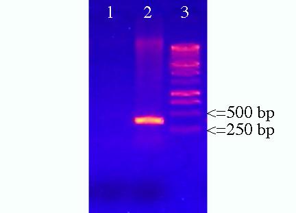 33 Figure 2. PCR products from malaria screening on a 1% agarose gel stained with ethidium bromide and visualized under UV light. Lane 1 represents a sample negative for malaria.