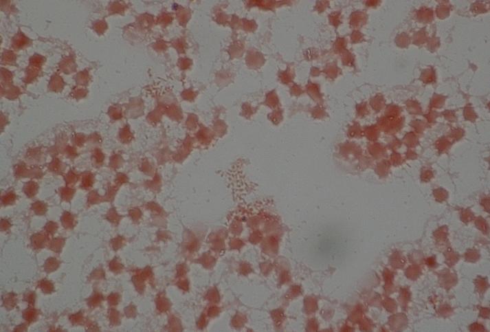 6 microns Faintly staining Gram-negative