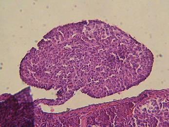 The testis from 26ºC had organization and distinct tubules within the medullary region, but many of those from