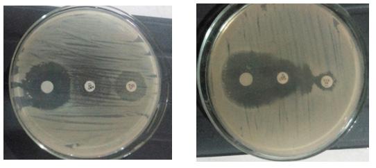 Percentage Production of ESBL and AmpC among Escherichia coli isolates Plate 1.