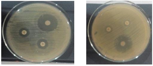 111 American Journal of Microbiological Research their study of Detection of ESBL- and AmpC-producing E. coli isolates from urinary tract infections in Iraq [23]. 4. Conclusion Plate 3.