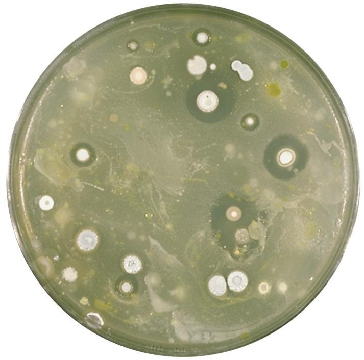 syphilis Alexander Fleming- 1928 Penicillium