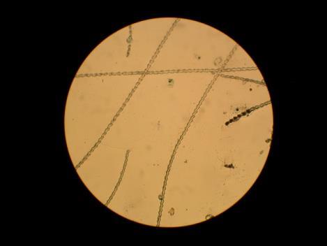 Keen s Myotis (Myotis keenii) Cuticular Root Scale Pattern at 200x. Keen s Myotis-Myotis keenii Cuticula coronal. Medulla not present.