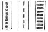 Figure 1: Cuticular and Medullar Patterns 34 Different scientists have come up with different classification criteria for cuticular and medullar patterns.