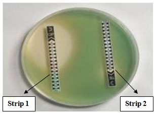 Figure 4 Strip 1 shows positive and strip 2 shows negative E Test. Table 1 MRSA screening with methicillin, disk diffusion and E test methods.