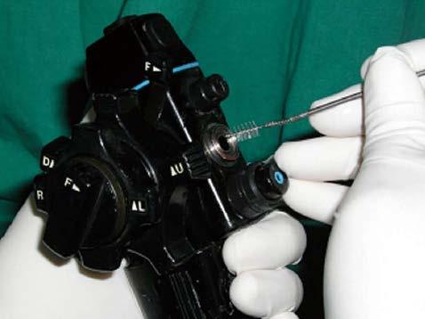 Manual cleaning of flexible endoscope: brushing and irrigation of internal channels Source: