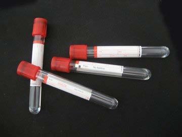 Red Top (Serum tubes) for