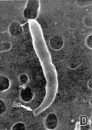 ) Protozoan parasite Cryptosporidium parvum Small infectious dose Incubation period 1-12 days, mean 7 days Profuse watery diarrhea, and cramping over days