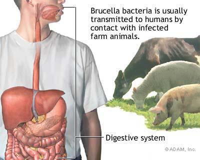 5 million (Knobel et al, 2005) Brucellosis 5% of cattle & 3% of buffaloes infected with brucellosis 1 ; up to 24% in some populations 2 Estimated annual