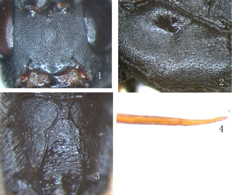 Introduction Rhimphoctona (Xylophylax) belonging to subfamily Campopleginae of the Ichneumonidae (Hymenoptera) are important parasitoids of woodborers.