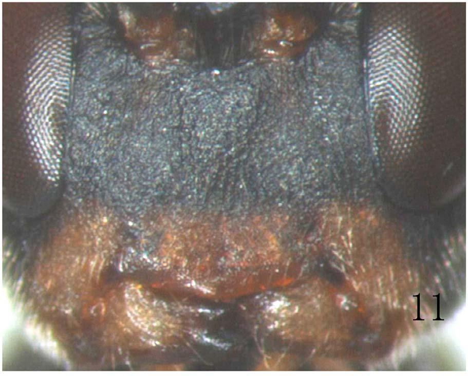 Figure 11: Rhimphoctona (Xylophylax) rufocoxalis (Clément, 1924). Face. High quality figures are available online. Distribution. China (Henan). Etymology.