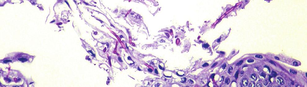 In this case, the lung and urinary bladder were negatively immunostained. Figure 5.