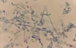 Fig. 1. Mycelia and rectangular arthroconidia of Geotrichum candidum in lactophenol cotton blue stain.