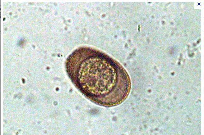 Figure 1: The following figure on the left displays a photo image of an Eimeria parasite collected from one of the three infected hosts.