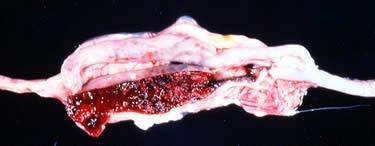 Gross lesions of E.