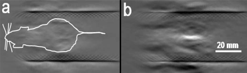 Figure 5. A typical optoacoustic image of a nude mouse before (a) and after (b) subcutaneous injection of 100 µl of Au-NRs at a concentration of 7.5 10 10 NRs per ml in the abdominal area.