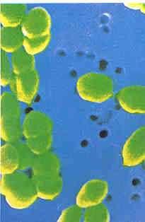 PMGH stats- Staphylococcus aureus from blood 2011-12 60% of 41 events due to MRSA Empiric