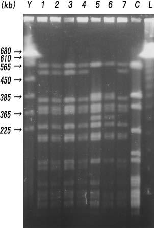 130 4 Tenover PFGE No. 5, 6 80 5. 24 No. 1 3 No. 1 2mm b 1mmb 7 2 PFGE SmaI 17: No. 17 Y: Yeast chromosomes, Saccharomyces cerevisiae C: 6. 24 48 72 11.5 mm 1 3 96 7 4 III.
