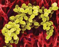 Major Healthcare-associated Infection Pathogens Methicillin-resistant Staphylococcus aureus (MRSA) Vancomycin-resistant Enterococcus spp.