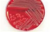 pdf). Recommendations For Preventing MRSA Transmission-Active Detection and Isolation (ADI) 1.