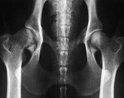 was not usually considered a criteria for the diagnosis of hip dysplasia.