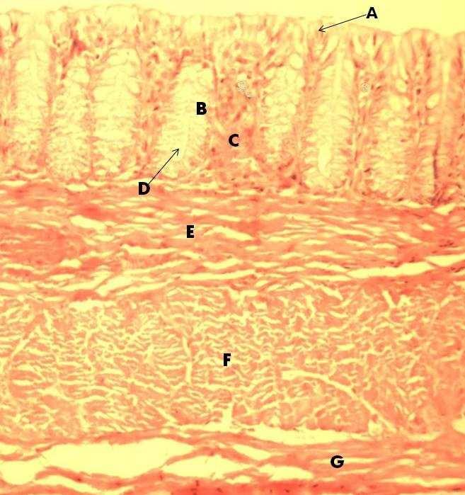 Plate V: Transverse section of the colon showing the epithelial lining (A), goblet cells (B), muscularismucosa (C), intestinal glands (D), submucosa (E),tunica muscularis (F) and tunica serosa (G).